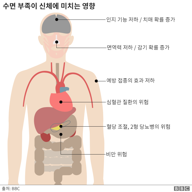_98546024_sleep_in_charts_body_v2_640_korean-nc.png